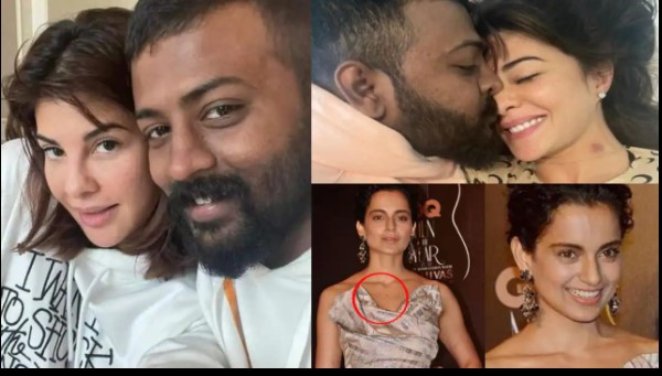 Bollywood celebs caught flaunting love bites and hickeys